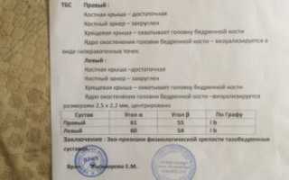 расшифровка узи тбс