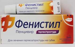 Герпес на губе как избавиться быстро