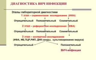 Диагностика ВИЧ