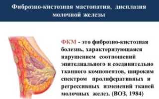 Фиброзно-кистозная трансформация лёгких