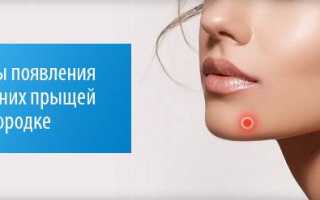На подбородке подкожные прыщи как убрать