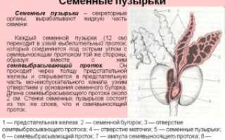 Увеличены семенные пузырьки