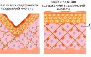 Крем с коллагеном и гиалуроновой кислотой