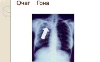 Очаги Гона