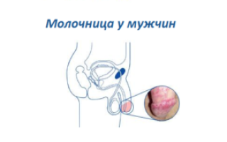 Натер головку