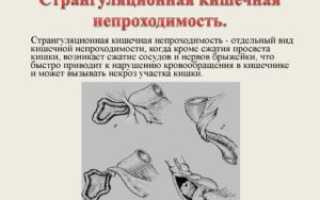 Странгуляционная непроходимость кишечника