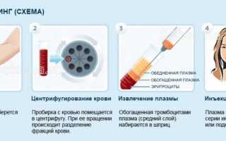 Как часто можно делать плазмолифтинг лица