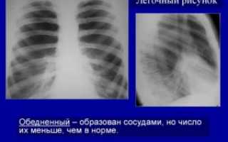 Что значит легочный рисунок нерезко деформирован?