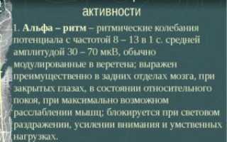 Изменение биоэлектрической активности общемозгового характера
