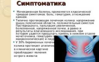 Симптомы болезни — боли в почке