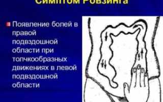 Симптомы болезни — боли в подвздошной области