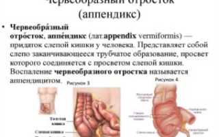 Опухоли червеобразного отростка