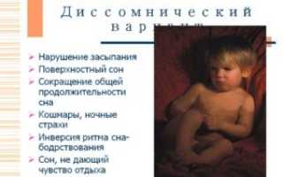 нарушение сна. поверхностный сон